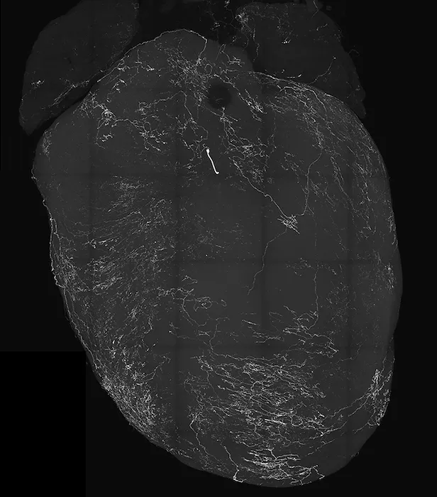 image of a heart in black and white with white lines representing vagal sensory neurons