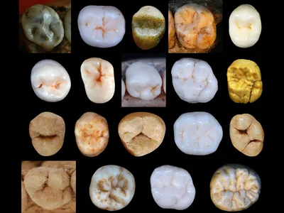 A collection of Hominin teeth used to determine the rate of tooth evolution among human ancestors.
