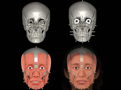 To recreate the face of a pregnant Egyptian woman, Hew Morrison first digitally mapped her skull, then added muscles and soft tissues&mdash;and, finally, the most subjective element: the eyes.